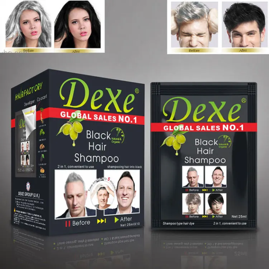 Dexe Madoobayso timaha